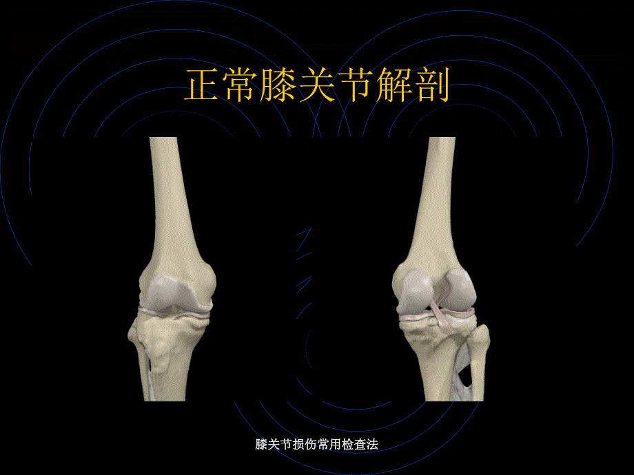 膝关节损伤常用检查法_第3页