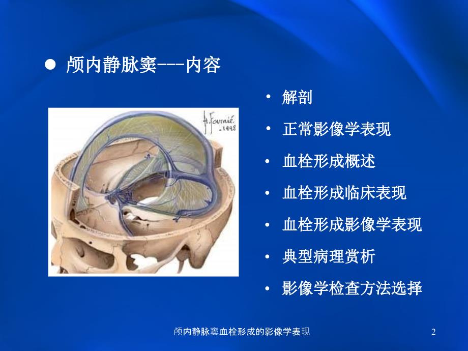 颅内静脉窦血栓形成的影像学表现课件_第2页