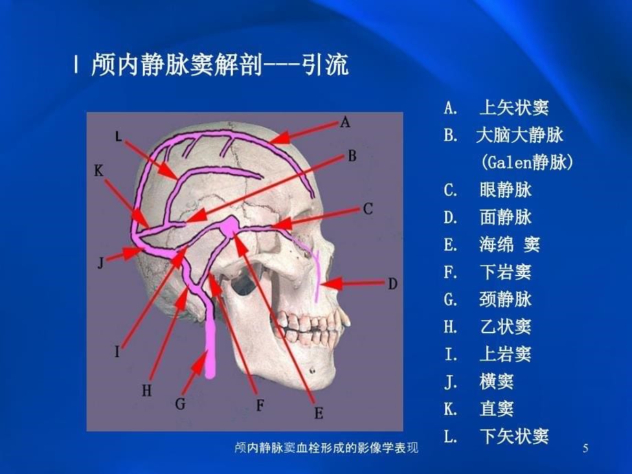 颅内静脉窦血栓形成的影像学表现课件_第5页