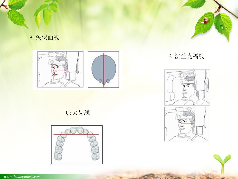 牙片机拍摄程序定位PPT课件_第3页