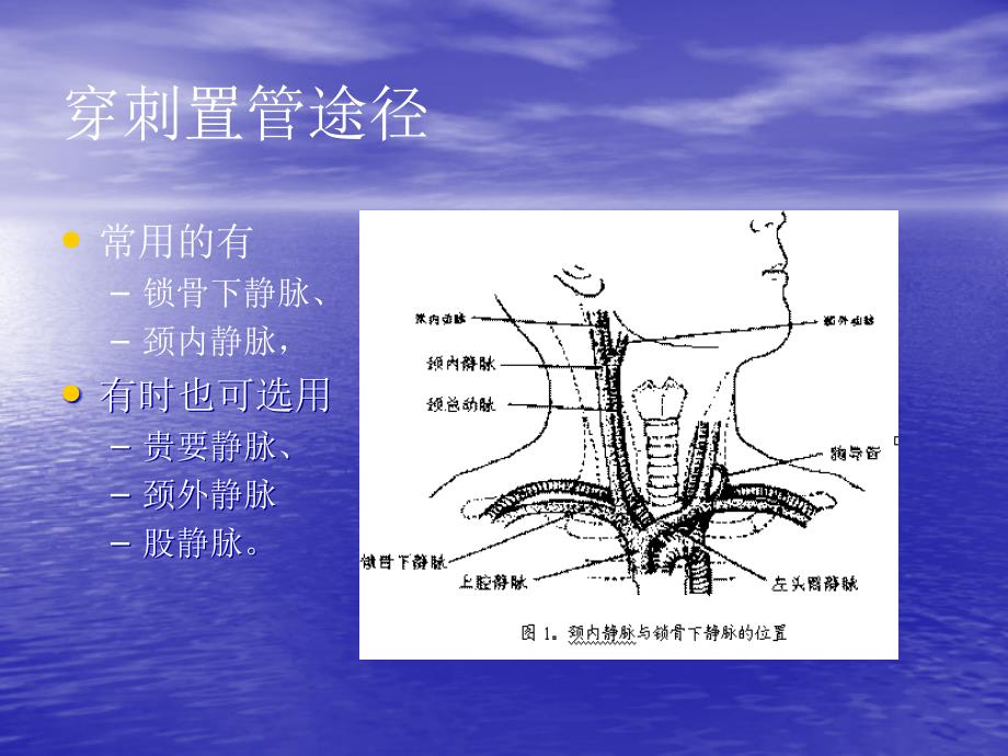 中心静脉穿刺置管术的临床应用_第3页