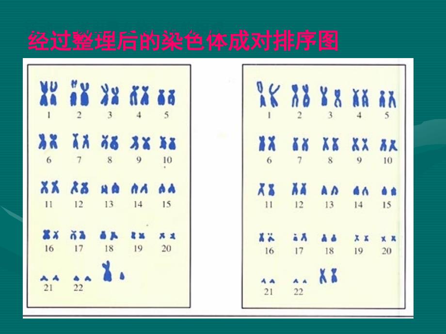 人类的性别决定_第3页