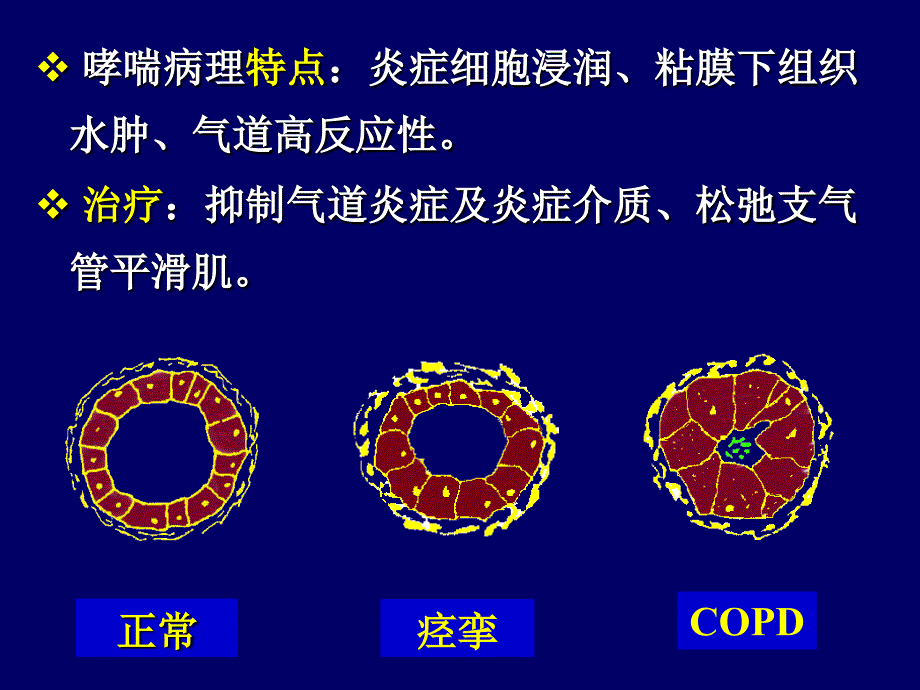 呼吸系统药物课件.ppt_第4页