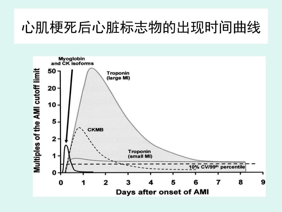 急性心肌梗死的急诊识别 ppt课件_第5页