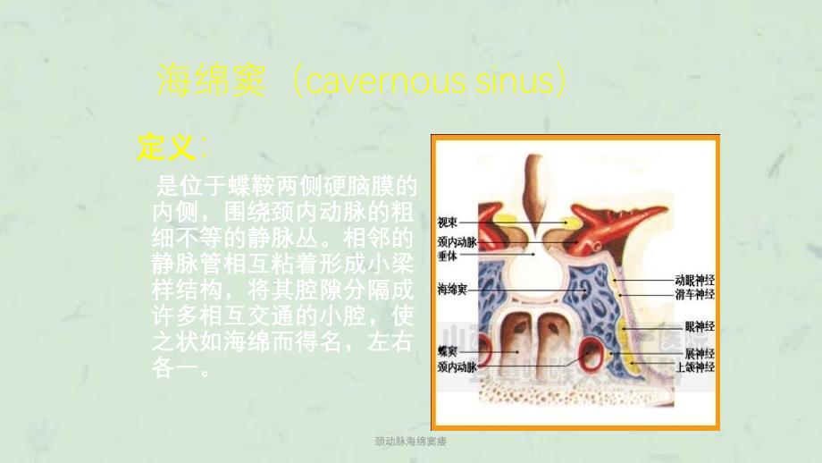 颈动脉海绵窦瘘课件_第2页