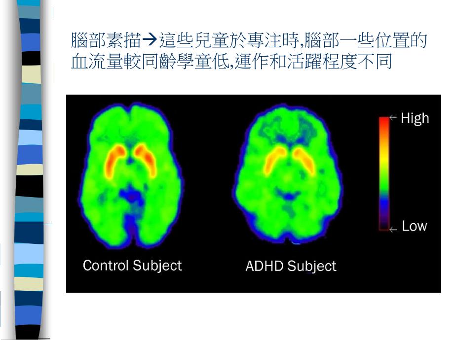 认识专注力不足过度活跃症实证治疗_第4页