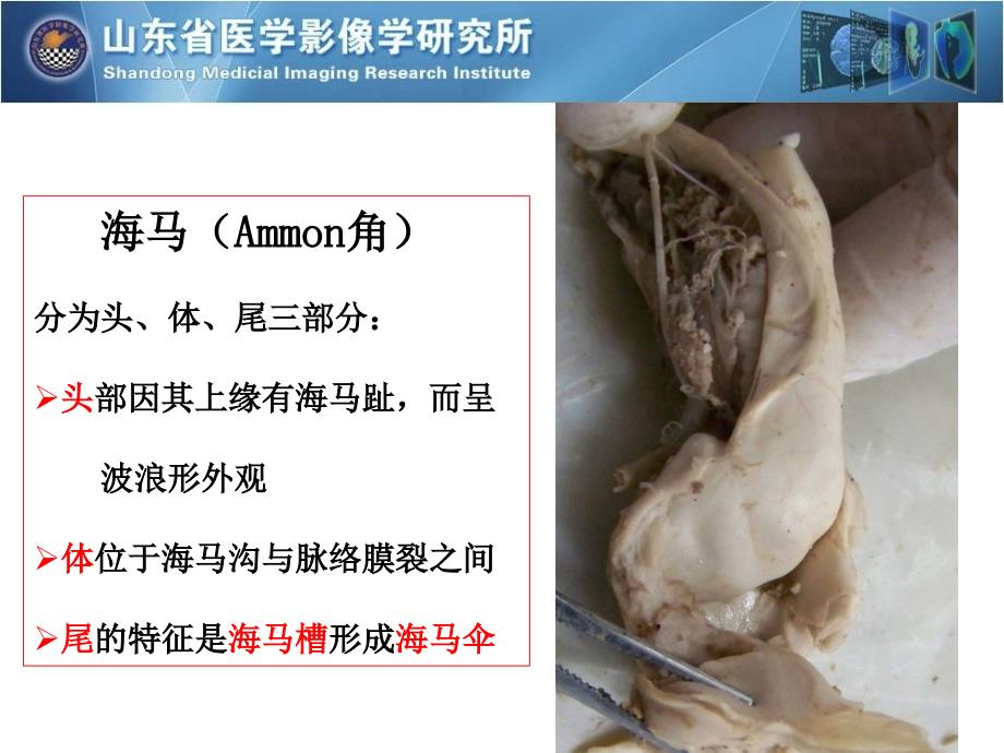 海马解剖与MR表现及临床【特制荟萃】_第2页