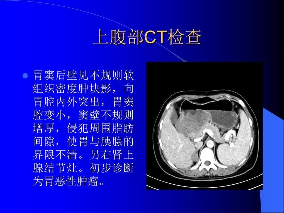 《腹部病例讨论》PPT课件_第5页