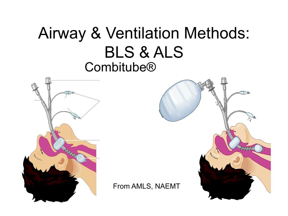 呼吸道通气方法ALS2_第4页