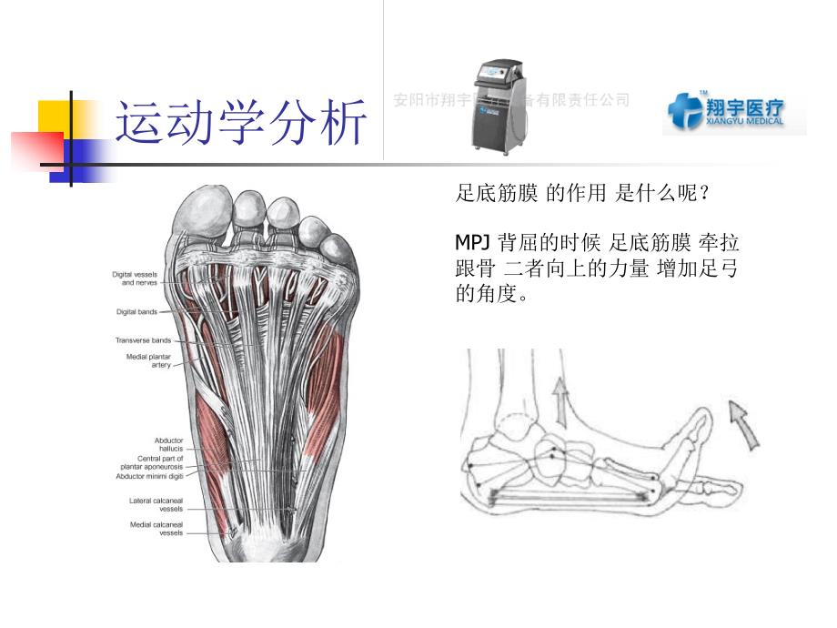 体外冲击治疗足底筋膜炎临床疗效分析_第4页