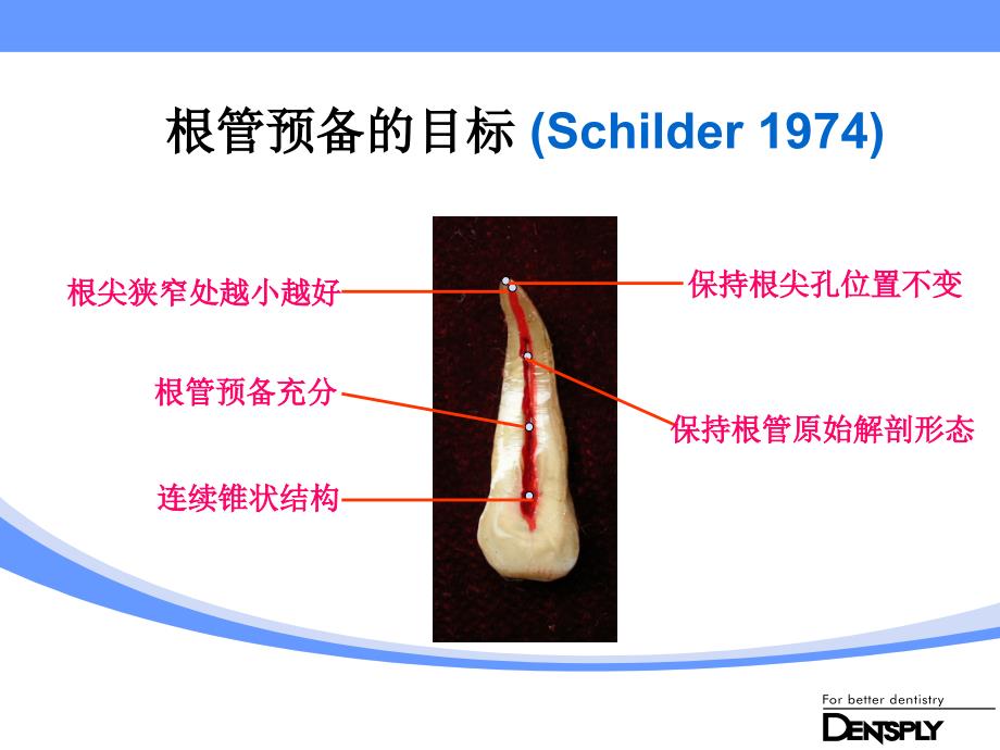 Protaper Universl 临床应用课件_第4页