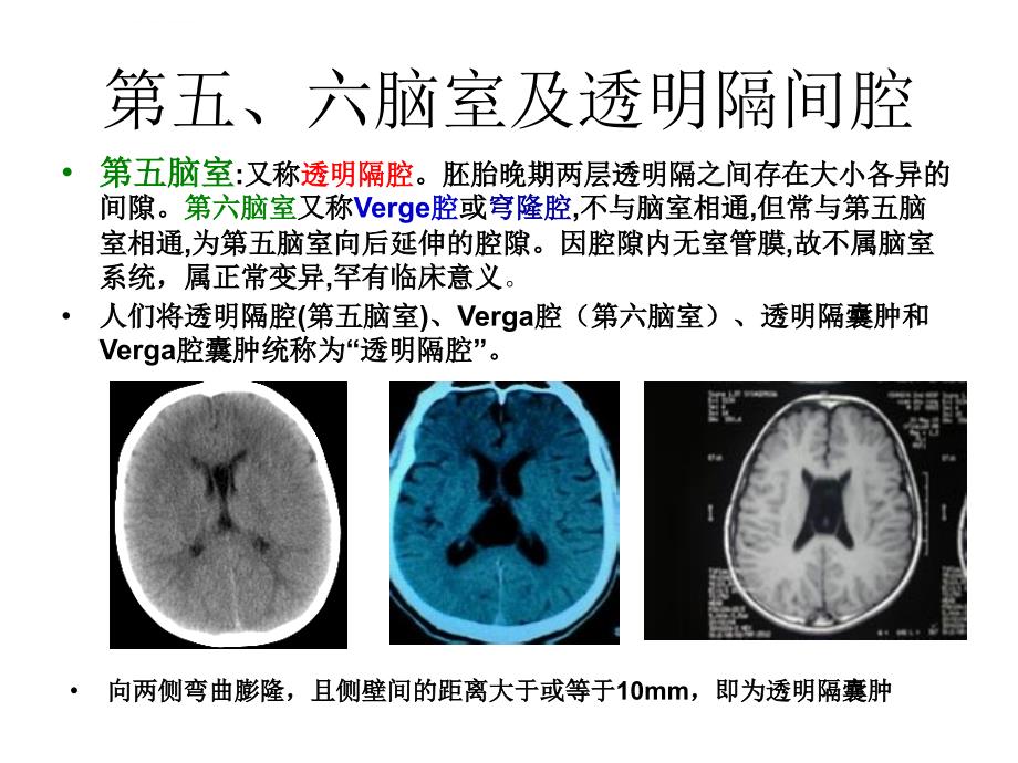 脑室系统及脑脊液循环ppt课件_第3页