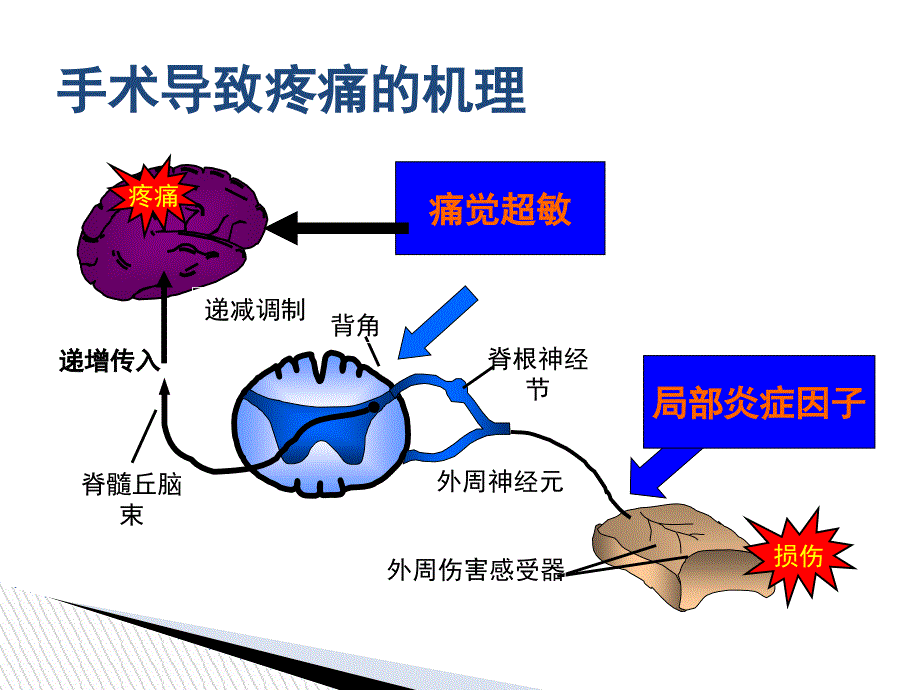 围手术期疼痛管理.ppt_第3页