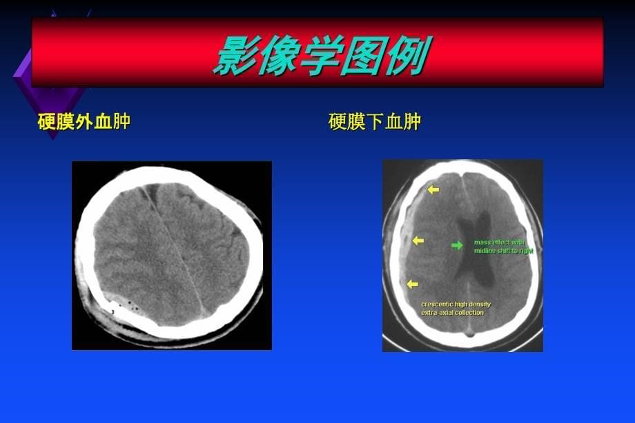 《创伤的诊断》PPT课件.ppt_第5页