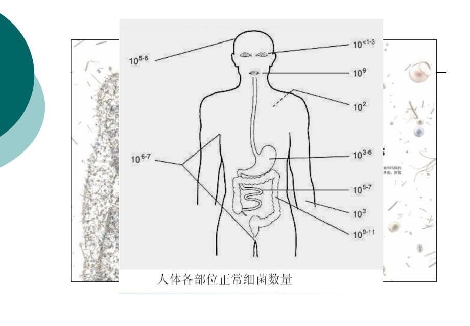 细菌的感染与免疫_第5页