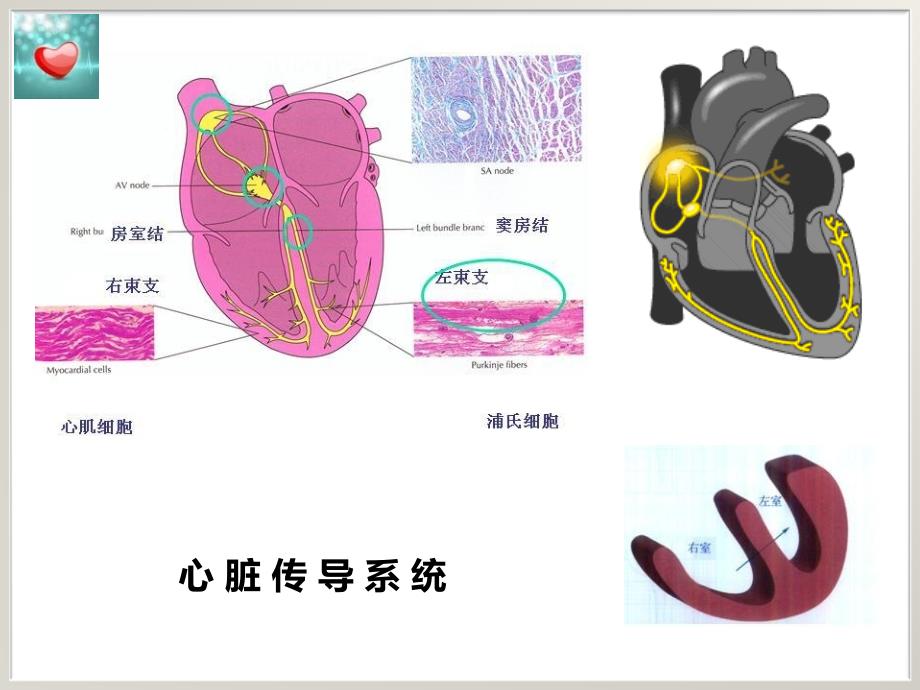 左束支传导阻滞与急性心肌梗死_第2页