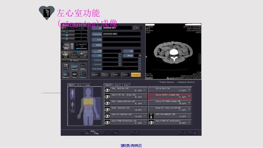 CT左心室功能成像实用教案_第2页