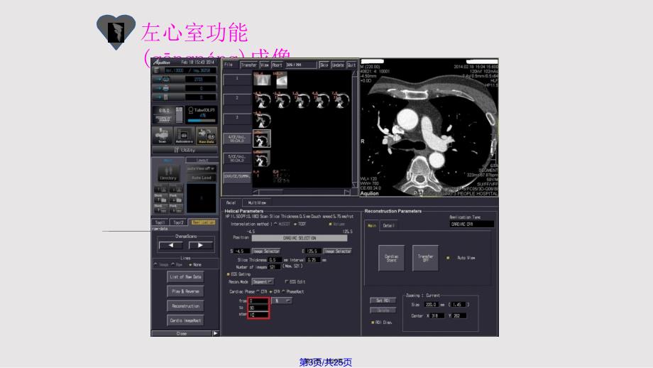 CT左心室功能成像实用教案_第3页