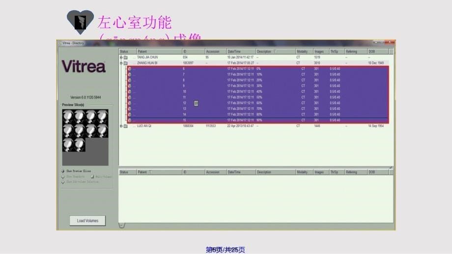 CT左心室功能成像实用教案_第5页