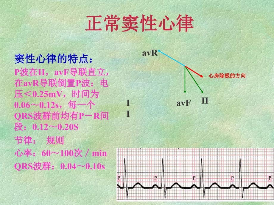 [所有分类]恶性心律失常的识别与理_第4页