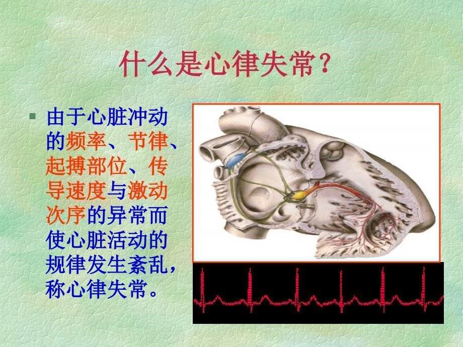 [所有分类]恶性心律失常的识别与理_第5页