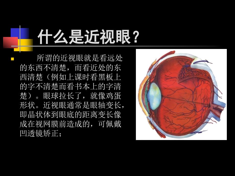 中学眼保健课件_第4页