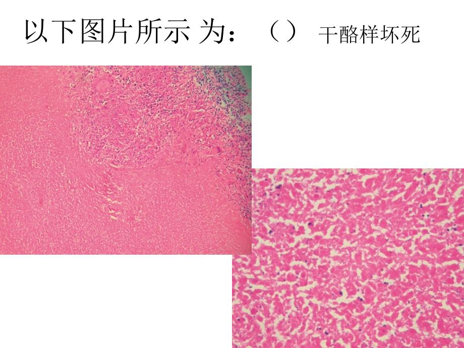 病理学实验：病理标本总复习_第4页