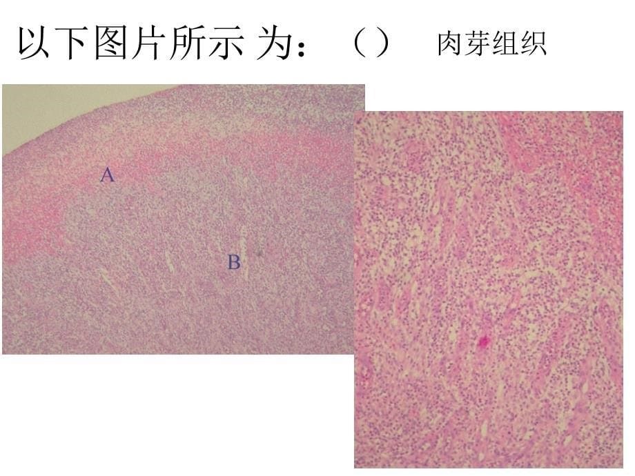 病理学实验：病理标本总复习_第5页