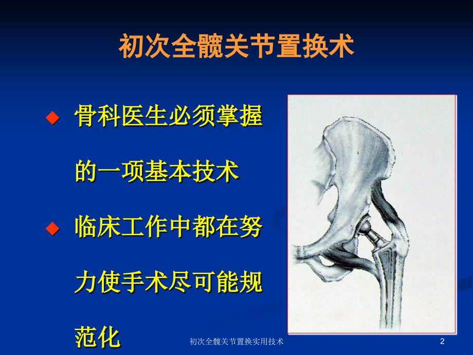 初次全髋关节置换实用技术课件_第2页