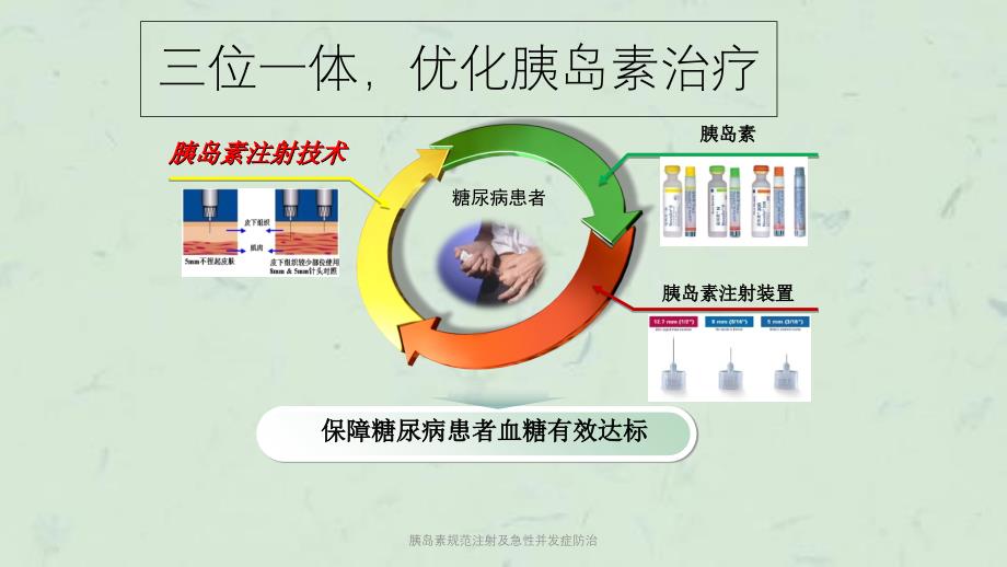 胰岛素规范注射及急性并发症防治课件_第3页