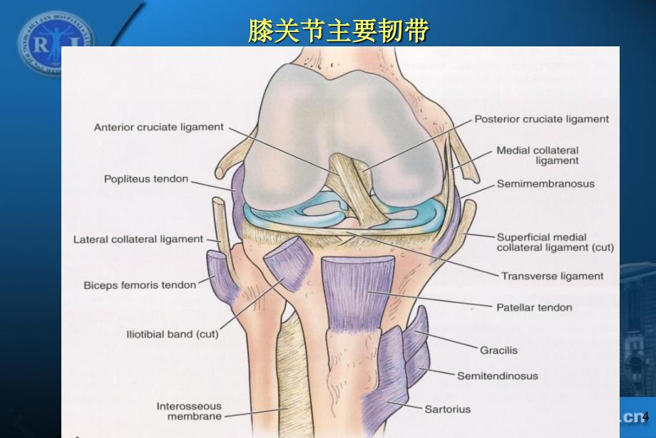 36膝关节韧带损伤的MR诊断丁晓毅dxyPPT课件_第4页