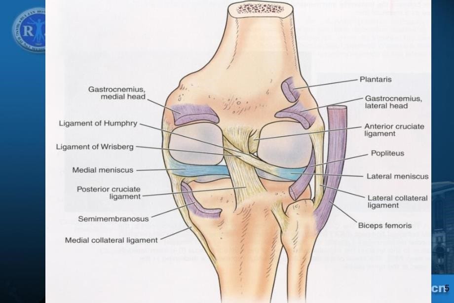 36膝关节韧带损伤的MR诊断丁晓毅dxyPPT课件_第5页