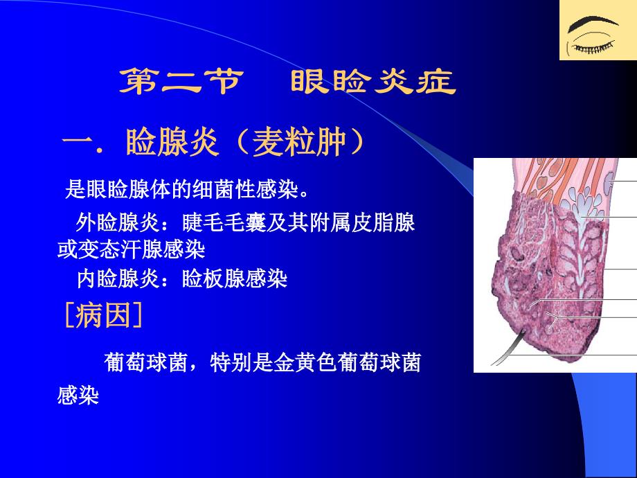 眼睑、泪器病_第4页