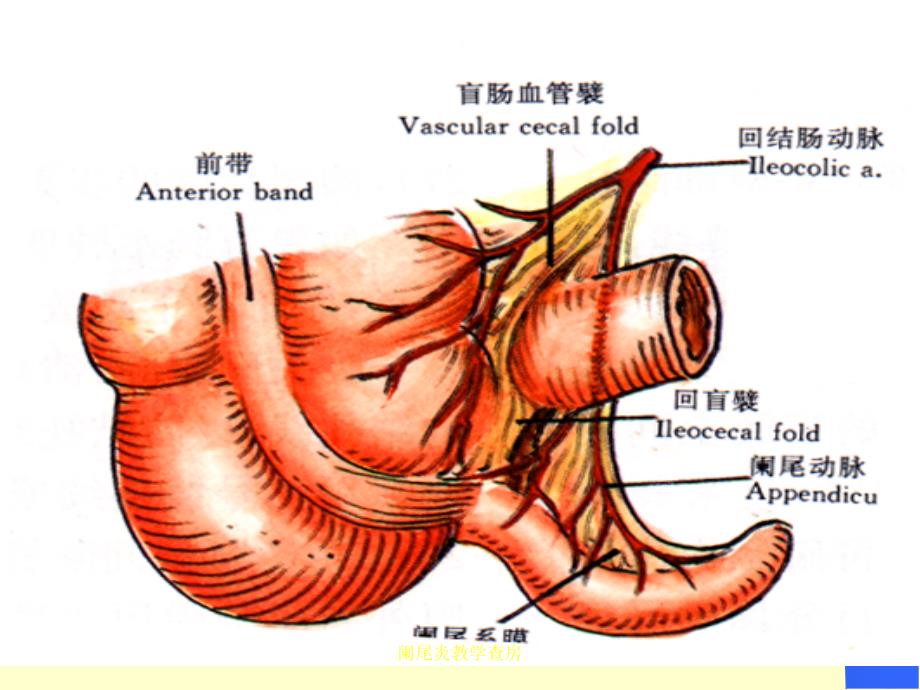 阑尾炎教学查房_第4页