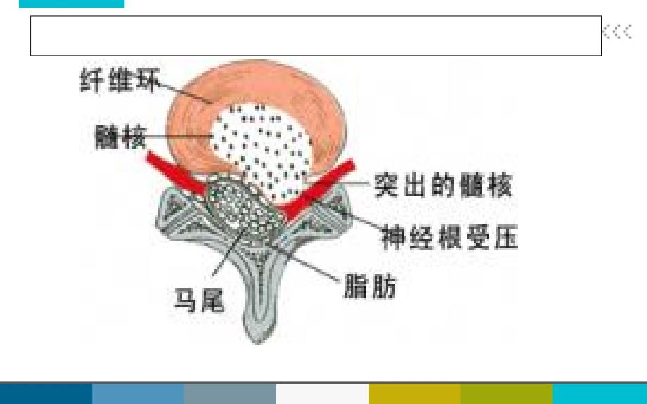 腰椎间盘术后护理教学内容_第4页