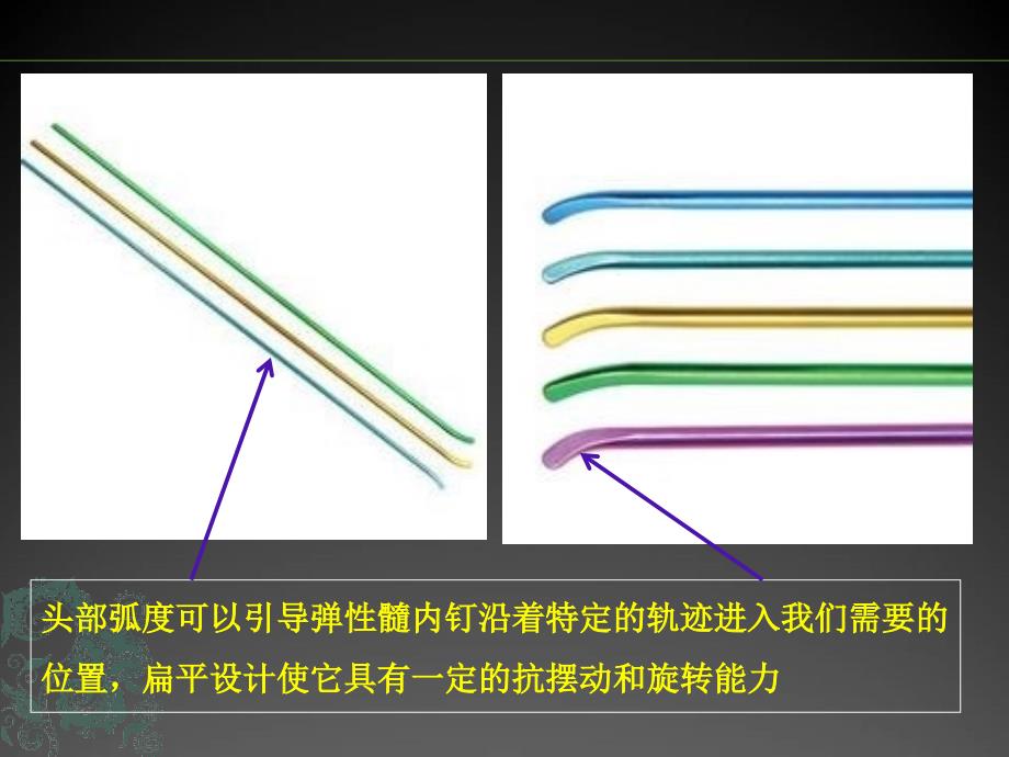 儿童长骨骨折弹性髓内钉课件_第3页