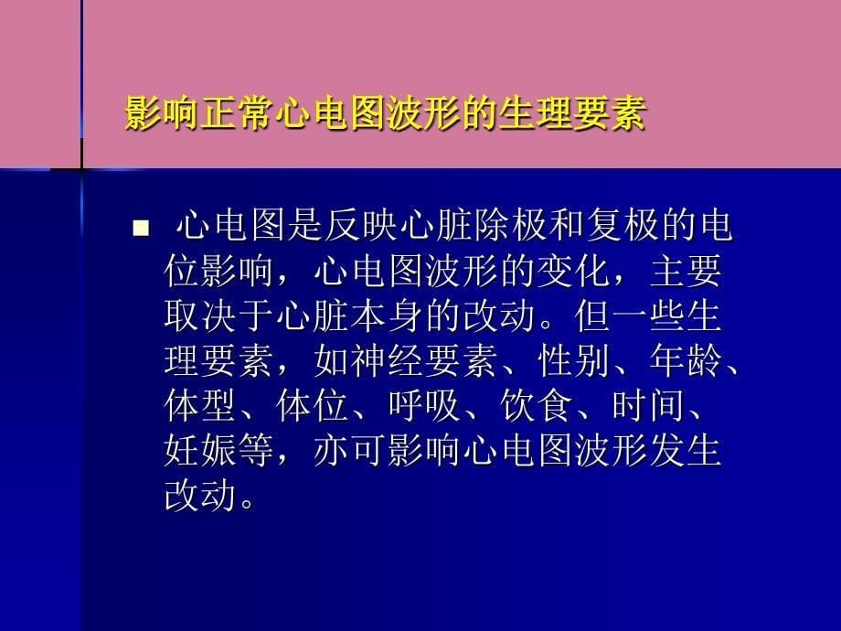 心电图诊断要点ppt课件_第5页