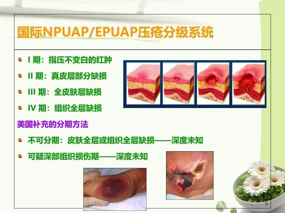 压疮的预防与护理课件_第5页