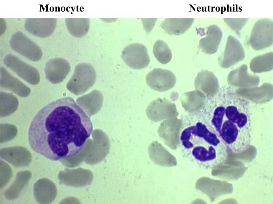 医学免疫学复习资料：Innate immunity_第5页