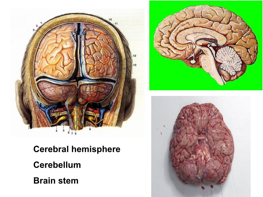 大脑高级皮层功能障碍_第3页