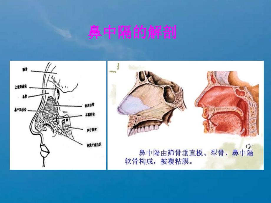 鼻中隔偏曲矫正术新ppt课件_第4页