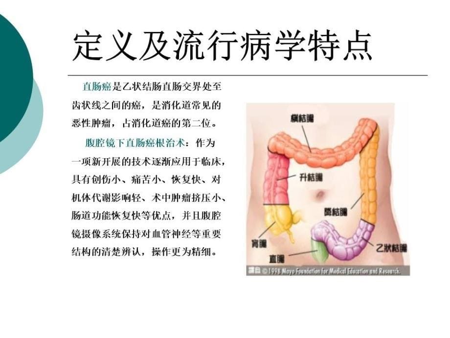 直肠癌的护理查房(教学)PPT课件.ppt_第5页