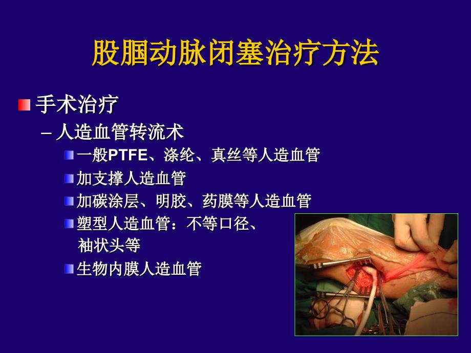 股腘动脉闭塞的外科与腔内治疗_第4页