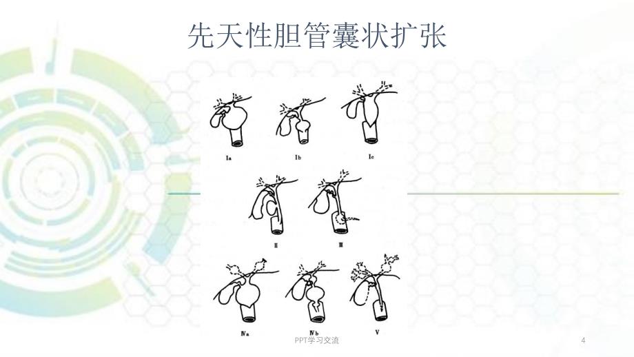 胆系影像诊断课件_第4页