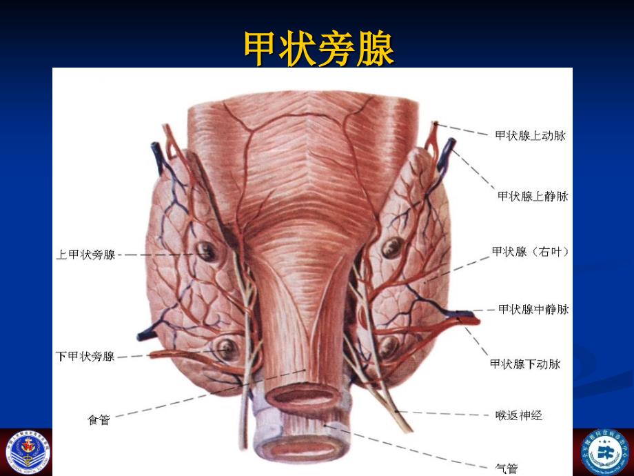 甲状旁腺功能亢进性骨病课件_第2页