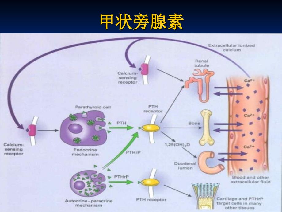 甲状旁腺功能亢进性骨病课件_第3页