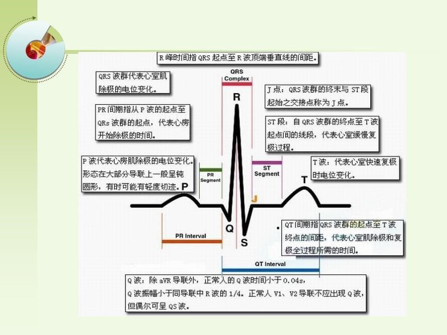 危险性心律失常的急救与护理(新)_第5页