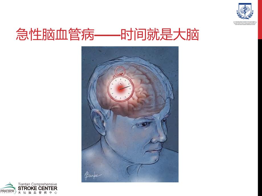 急性脑卒中医疗救治技术方案.ppt_第2页