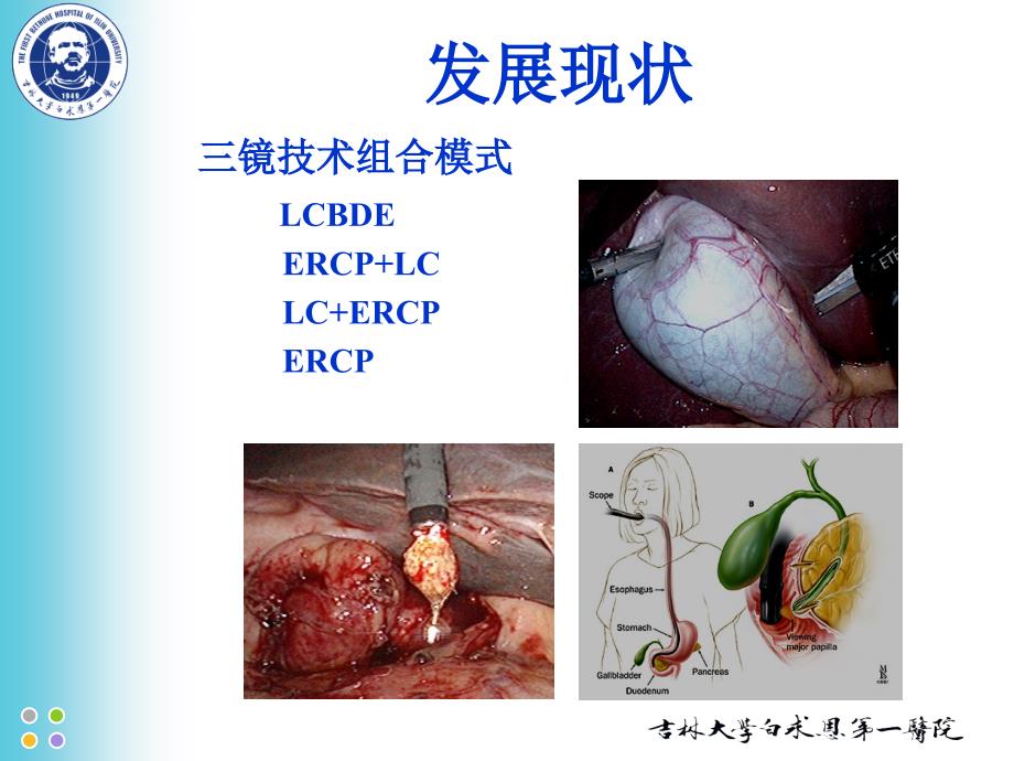 胆囊切除胆道探查T管引流ppt课件_第4页