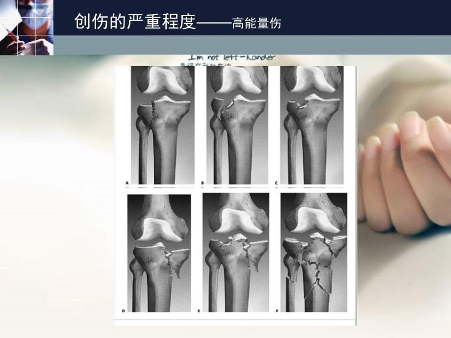 多发伤的诊断与治疗_第5页